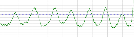 EMG biofeedback software showing chest breathing