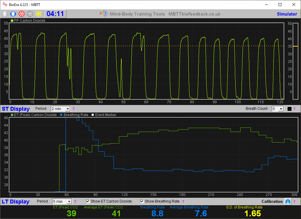basic capnometry app main window