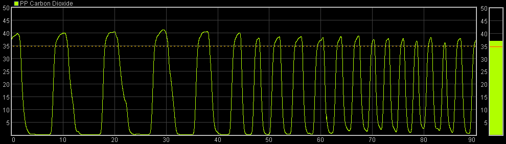 capnometer biofeedback trace