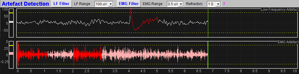 eeg assessment app artefact monitoring