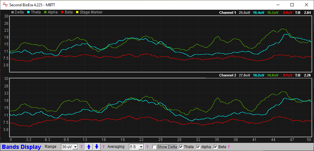 eeg assessment app bands charts