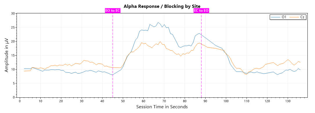 eeg assessment line chart