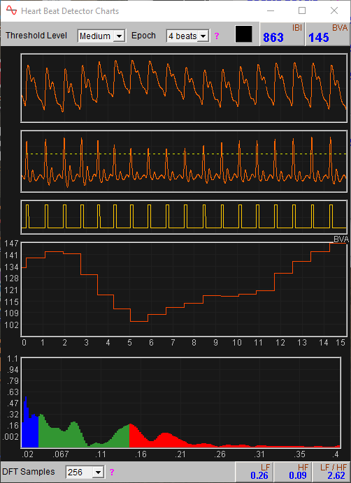 PPG beat detection window