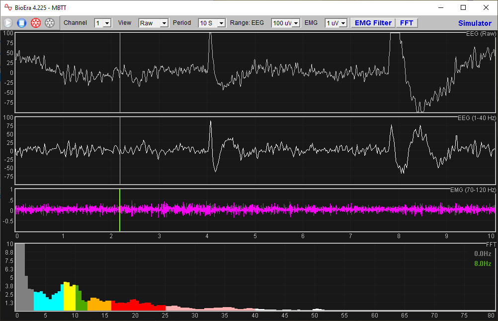 bioera EEG inspection app