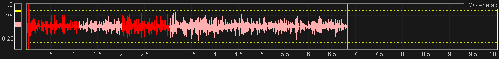 eeg neurofeeback muscle artefact