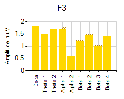 Site comparison chart