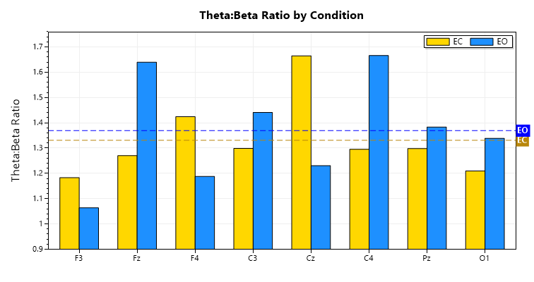 theta to beta ratio chart